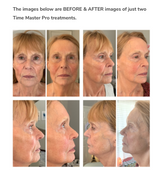 4 x Time Master Pro® Retail $3200 - SPECIAL OFFER