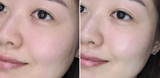 VALUE - Hyal-Moisture Solution Ampoule 150mL Retail $170 - SPECIAL OFFER