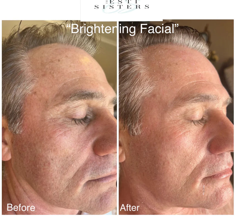 Advanced Skin Brightening Facial Backbar Bundle - DR. ESTHE