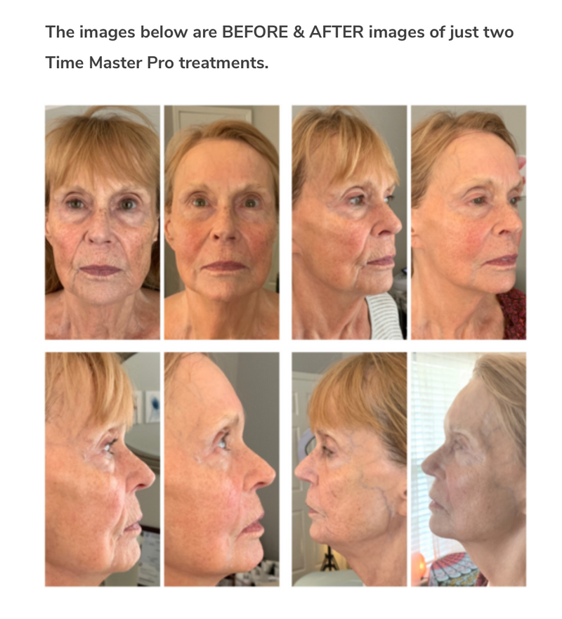 Time Master Pro® ONLY - NO GEL! Retail $750 - SPECIAL OFFER